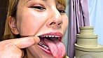 健康優良口内！なつきちゃんの日内観察