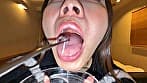 【個人撮影】さくまつなの舌ブラシで「汚舌苔」採取