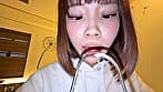 【個人撮影】渡来ふうの舌ブラシで「汚舌苔」採取