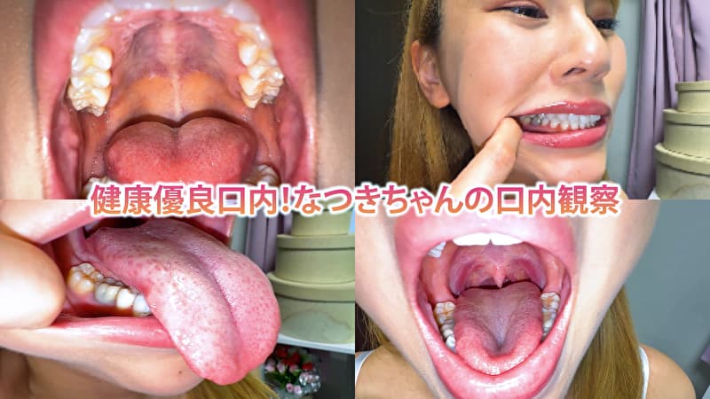 健康優良口内！なつきちゃんの日内観察