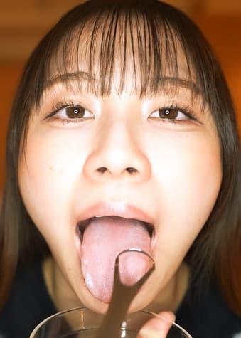 【個人撮影】さくまつなの舌ブラシで「汚舌苔」採取