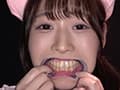 野こはるチャンの舌ベロ・歯・口内・のどちんこ観察