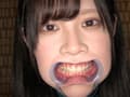 エマちゃんの歯・口内・舌ベロを観察してみた