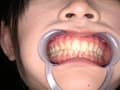 エマちゃんの歯・口内・舌ベロを観察してみた