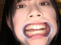 エマちゃんの歯・口内・舌ベロを観察してみた
