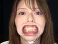 人気女優の激レアな歯・治療跡・のどちんこ観察！