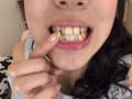 牧野れいなちゃんの歯・口内自撮り＆ベロ観察