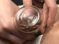 蜚蠊に難い雌襞と○蝕に斑液