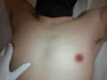 M男くすぐりぐりぬきキャンペーン