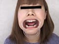 歯、痛いですか？ 素人娘たちの意識調査