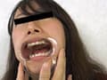 歯、痛いですか？ 素人娘たちの意識調査