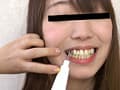 歯、痛いですか？ 素人娘たちの意識調査