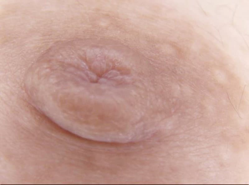 300人の乳首 3