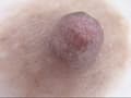 300人の乳首 3