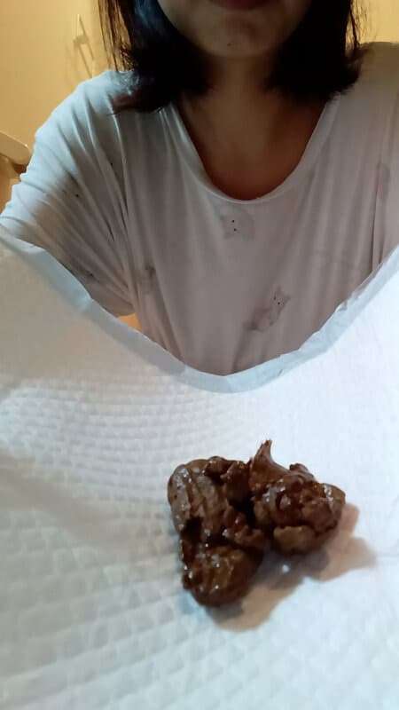 うんこのやま