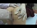 【動画】医療と肛門 PART1 「肛門限界拡張診療」