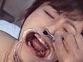 女子囚人患者
