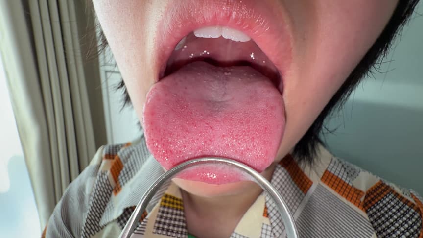 【個人撮影】加護まりの舌ブラシで「汚舌苔」採取