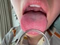 【個人撮影】加護まりの舌ブラシで「汚舌苔」採取