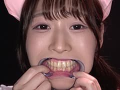 野こはるチャンの舌ベロ・歯・口内・のどちんこ観察