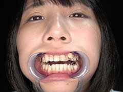 人気女優の激レアな歯・銀歯・口内・のどちんこ観察!