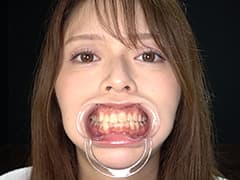 人気女優の激レアな歯・治療跡・のどちんこ観察!