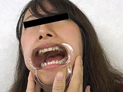 歯、痛いですか? 素人娘たちの意識調査