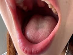 街角で声をかけて口内観察させてもらう あいるちゃん